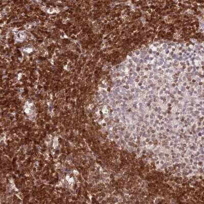 Immunohistochemistry-Paraffin: SELH Antibody [NBP2-14637]
