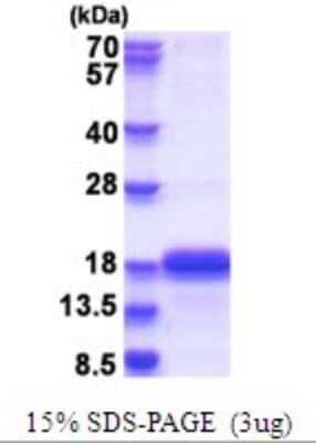 SDS-PAGE: Recombinant Human SELH His Protein [NBP2-51687]