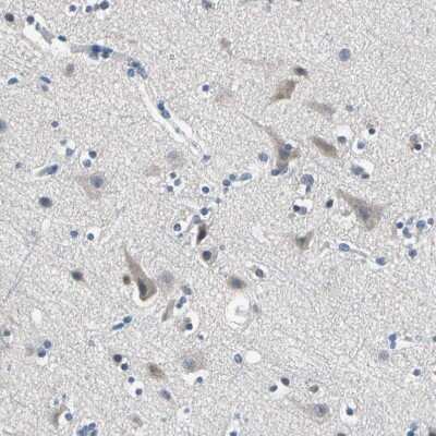 Immunohistochemistry-Paraffin: SELK Antibody [NBP1-86120]