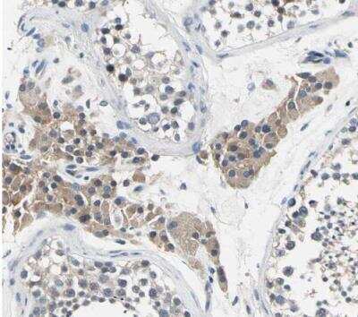 Immunohistochemistry-Paraffin: SELK Antibody [NBP1-86120]