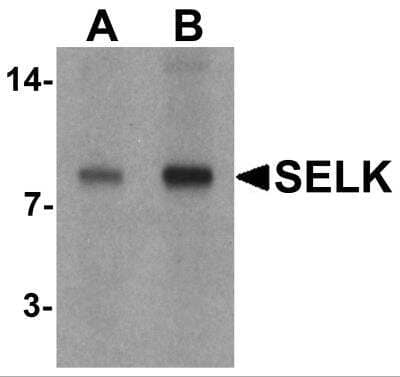 Western Blot: SELK AntibodyBSA Free [NBP2-81791]