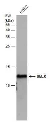 Western Blot: SELK Antibody [NBP3-12991]