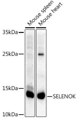 Western Blot: SELK AntibodyAzide and BSA Free [NBP3-16050]