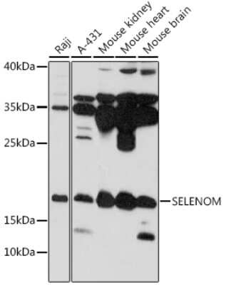 Western Blot: SELM AntibodyAzide and BSA Free [NBP2-94301]