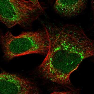 Immunocytochemistry/ Immunofluorescence: SELRC1 Antibody [NBP1-87392]