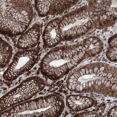 Immunohistochemistry-Paraffin: SELRC1 Antibody [NBP1-87392]
