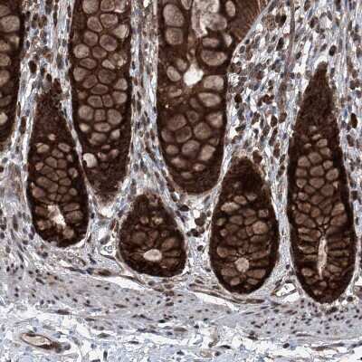 Immunohistochemistry-Paraffin: SELRC1 Antibody [NBP1-87392]