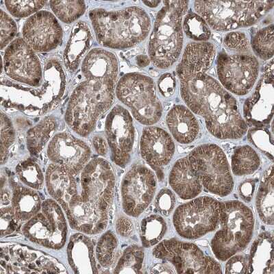 Immunohistochemistry-Paraffin: SELRC1 Antibody [NBP1-87392]