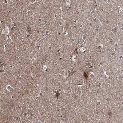 Immunohistochemistry-Paraffin: SELRC1 Antibody [NBP1-87392]