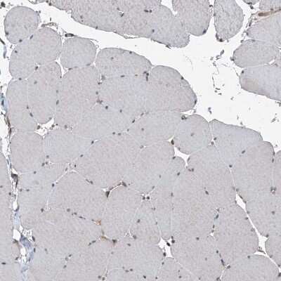 Immunohistochemistry-Paraffin: SELRC1 Antibody [NBP1-87392]