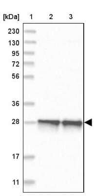 Western Blot: SELRC1 Antibody [NBP1-87392]