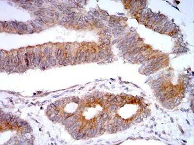 Immunohistochemistry: SELS Antibody (7F8G1) - BSA Free [NBP2-61876]
