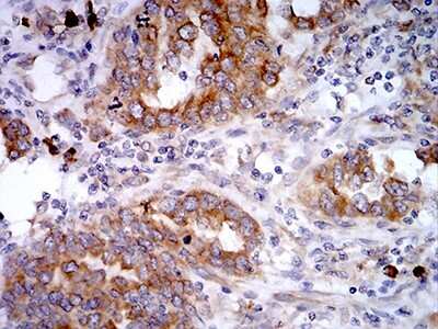 Immunohistochemistry: SELS Antibody (7F8G1) - BSA Free [NBP2-61876]