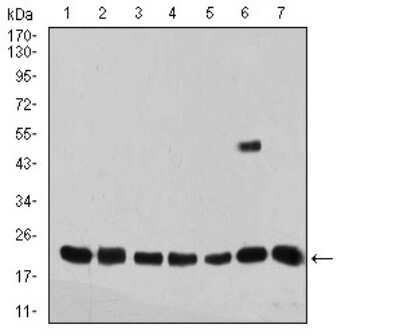 Western Blot: SELS Antibody (7F8G1)BSA Free [NBP2-61876]