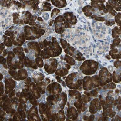 Immunohistochemistry-Paraffin: SELS Antibody [NBP1-89558]