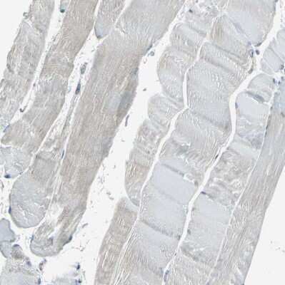 Immunohistochemistry-Paraffin: SELS Antibody [NBP1-89558]