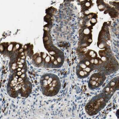 Immunohistochemistry-Paraffin: SELS Antibody [NBP1-89558]