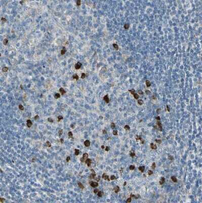 Immunohistochemistry-Paraffin: SELS Antibody [NBP1-89558]