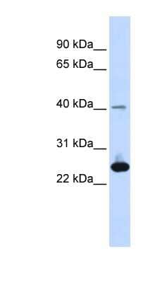 Western Blot: SELS Antibody [NBP1-59042]