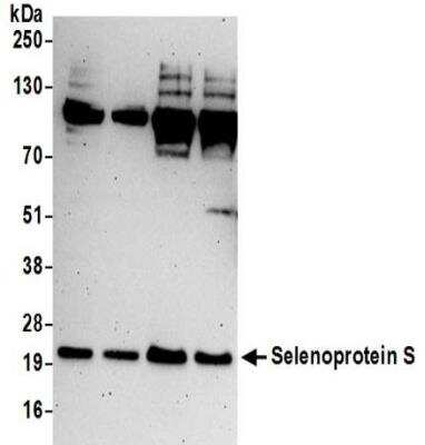 Western Blot: SELS Antibody [NBP2-32096]