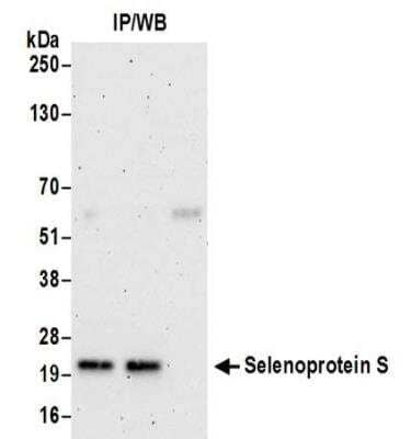 Western Blot: SELS Antibody [NBP2-32096]