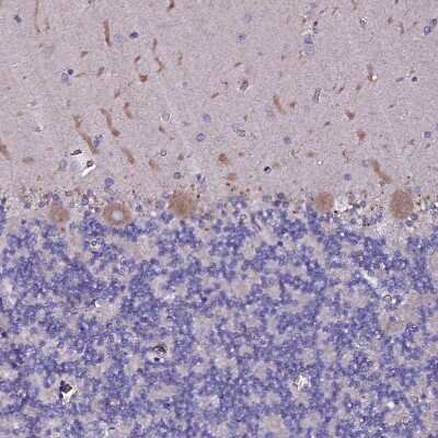 Immunohistochemistry-Paraffin: SELT Antibody [NBP1-90979]