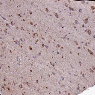 Immunohistochemistry-Paraffin: SELT Antibody [NBP1-90979]