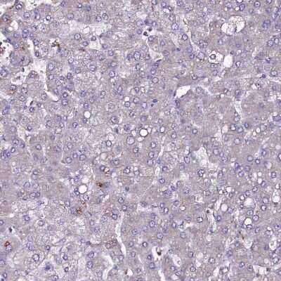 Immunohistochemistry-Paraffin: SELT Antibody [NBP1-90979]