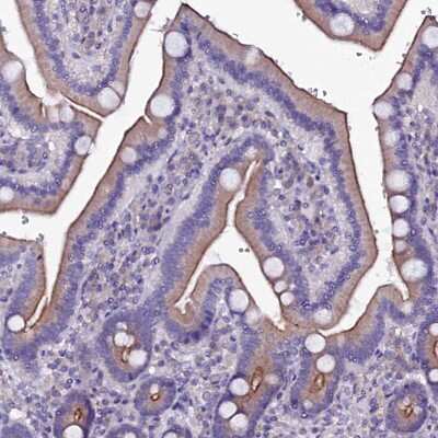 Immunohistochemistry-Paraffin: SELT Antibody [NBP1-90979]