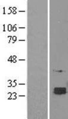 Western Blot: SELT Overexpression Lysate [NBL1-15797]