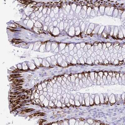 Immunohistochemistry: SELV Antibody [NBP2-32446]