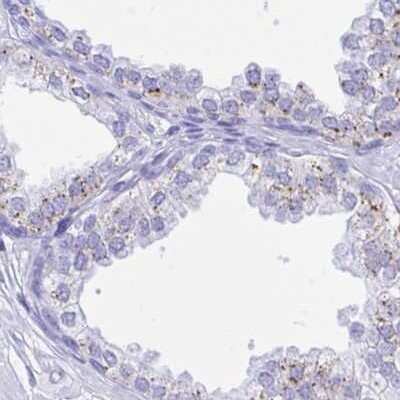 Immunohistochemistry: SELV Antibody [NBP2-32446]