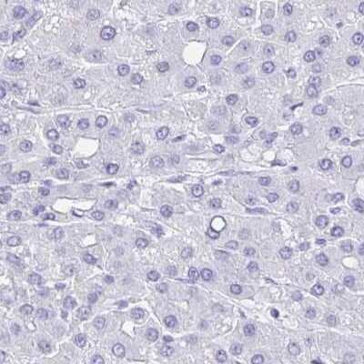 Immunohistochemistry: SELV Antibody [NBP2-32446]