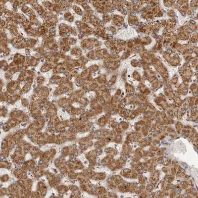 Immunohistochemistry-Paraffin: Semaphorin 3A Antibody [NBP1-84409]