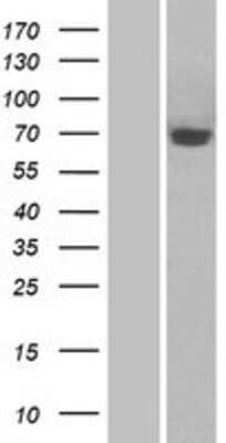 Western Blot: Semaphorin 3A Overexpression Lysate [NBP2-07669]