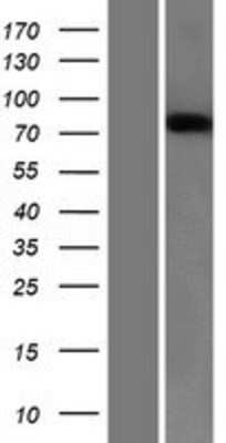 Western Blot: Semaphorin 3B Overexpression Lysate [NBL1-15798]