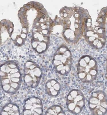 Immunohistochemistry-Paraffin: SEMA3D Antibody [NBP1-85517]