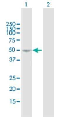 Western Blot: SEMA3D Antibody [H00223117-B01P]