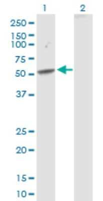 Western Blot: SEMA3D Antibody [H00223117-D01P]