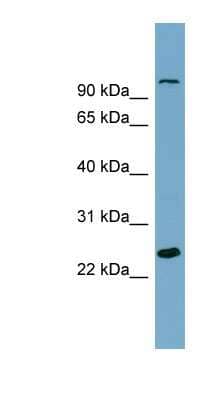 Western Blot: SEMA3D Antibody [NBP1-59505]