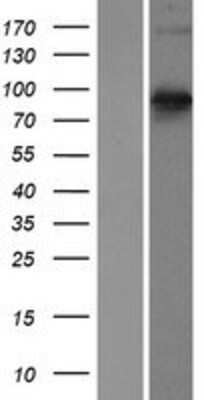 Western Blot: Semaphorin 3E Overexpression Lysate [NBP2-07444]