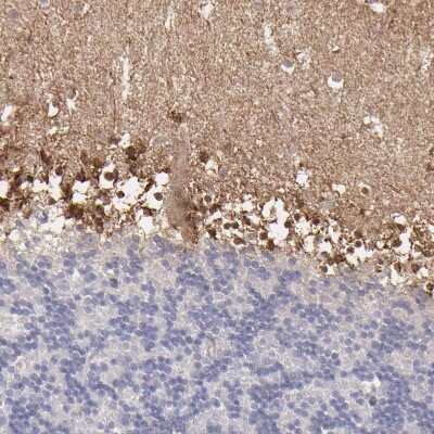 Immunohistochemistry-Paraffin: SEMA3G Antibody [NBP1-83881]