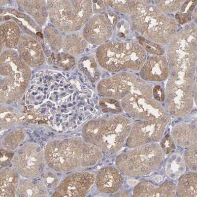 Immunohistochemistry-Paraffin: SEMA3G Antibody [NBP1-83881]