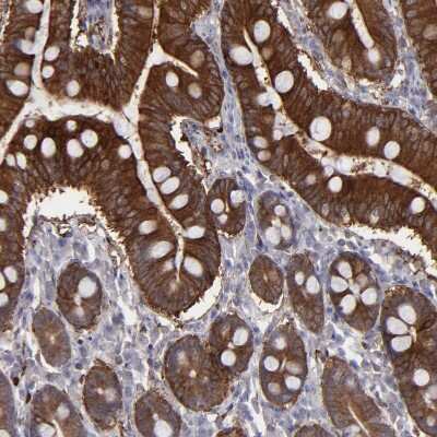 Immunohistochemistry-Paraffin: SEMA3G Antibody [NBP1-83881]