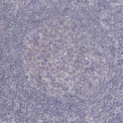 Immunohistochemistry-Paraffin: SEMA3G Antibody [NBP1-83881]