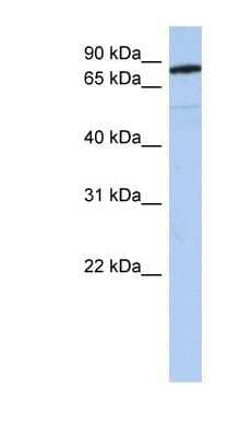 Western Blot: Semaphorin 4B Antibody [NBP1-62242]