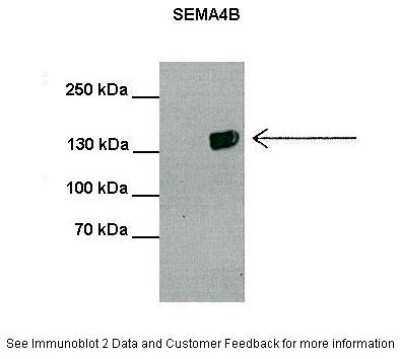 Western Blot: Semaphorin 4B Antibody [NBP1-62242]