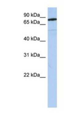 Western Blot: Semaphorin 4B Antibody [NBP1-69276]