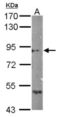 Western Blot: Semaphorin 4B Antibody [NBP2-19299]