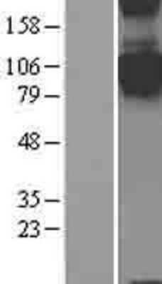 Western Blot: Semaphorin 4C Overexpression Lysate [NBL1-15802]